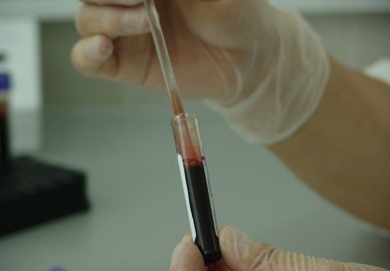 Blood analysis